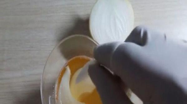 عکس رنگ ادرار در بارداری