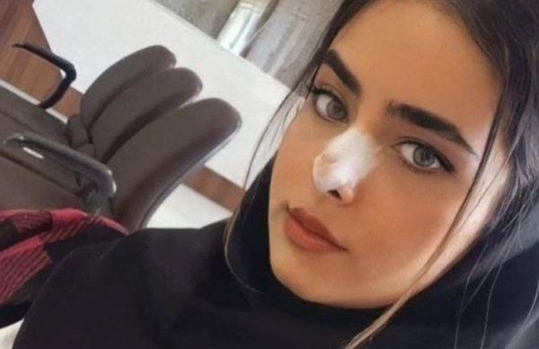 عکس زیباترین دختر تبریزی