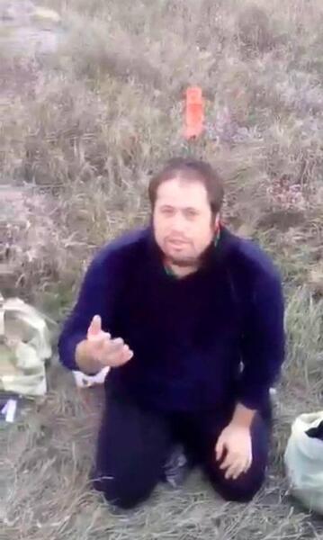 عکس چاقو خوردگی سر