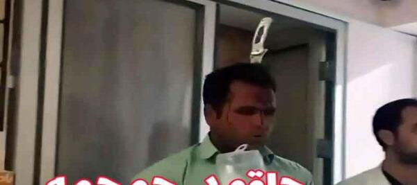 عکس چاقو خوردگی سر
