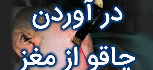 عکس چاقو خوردگی سر