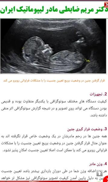 عکس جنین در حالت نشسته