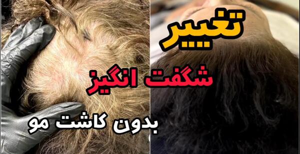 عکس شقایق فراهانی قبل از عمل بینی