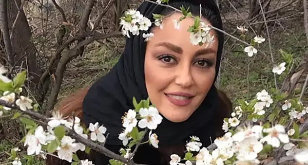 عکس شقایق فراهانی قبل از عمل بینی