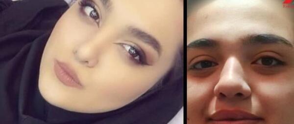 عکس های لیسا قبل از عمل