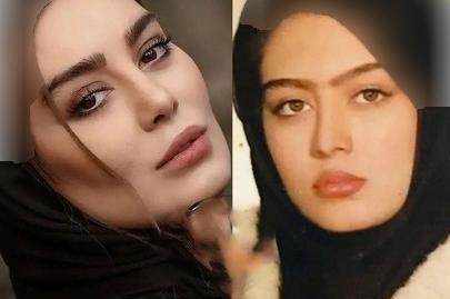 عکس های لیسا قبل از عمل