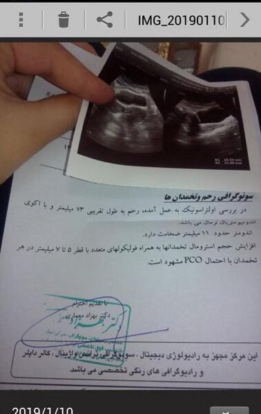 عکس و تصویر دهانه رحم سالم