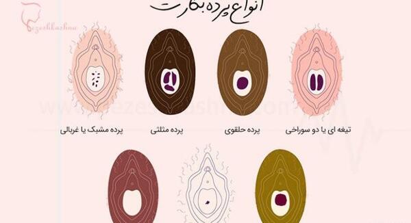 عکس و تصویر دهانه رحم سالم