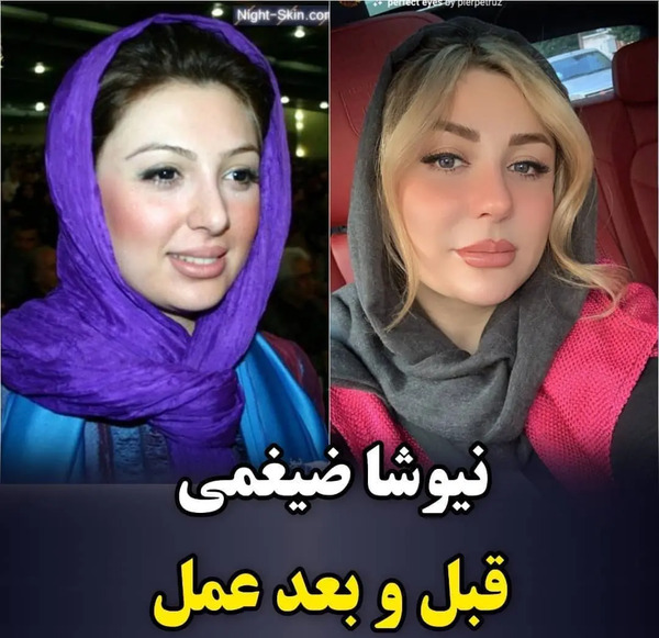 عکس عکس نیوشا ضیغمی