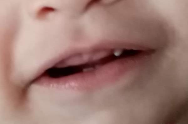 عکس ترسناک نی نی سایت