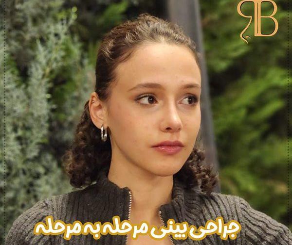 عکس روز اول جراحی بینی