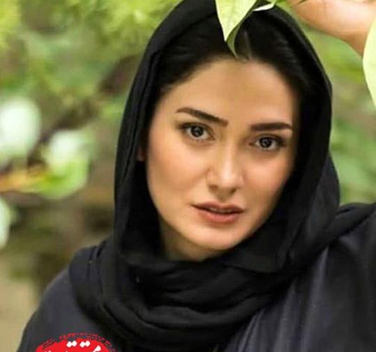عکس مینا وحید قبل عمل