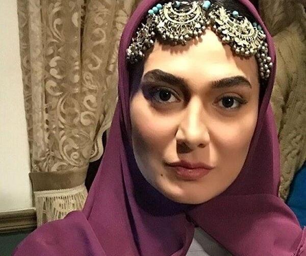 عکس مینا وحید قبل عمل