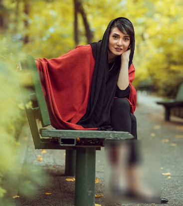 عکس مینا وحید قبل عمل