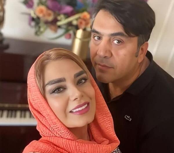 عکس صبا راد قبل از عمل