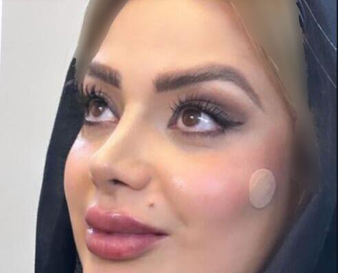 عکس صبا راد قبل از عمل