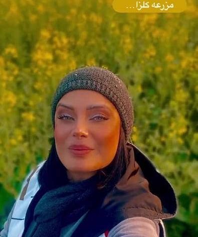 عکس صبا راد قبل از عمل