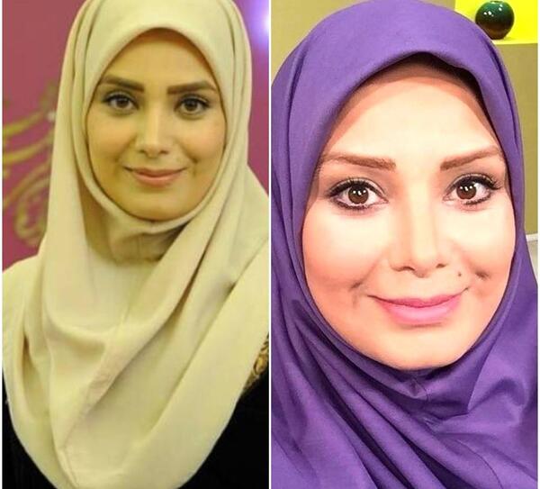 عکس صبا راد قبل از عمل