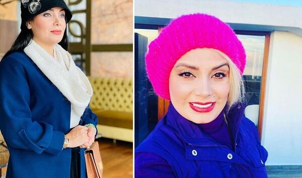 عکس صبا راد قبل از عمل
