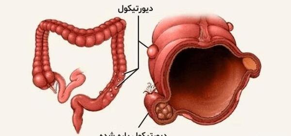 عکس داخل شکم انسان واقعی