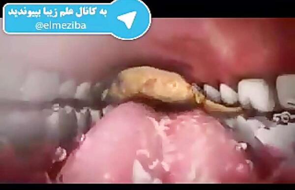 عکس داخل شکم انسان واقعی