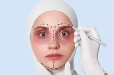 عکس کبودی صورت نامداری