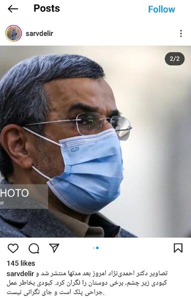 عکس کبودی صورت نامداری