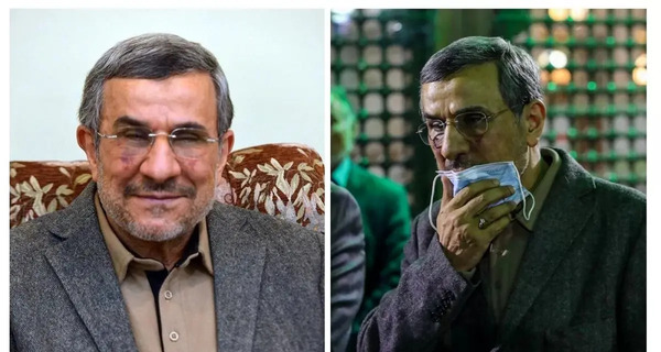 عکس کبودی صورت نامداری