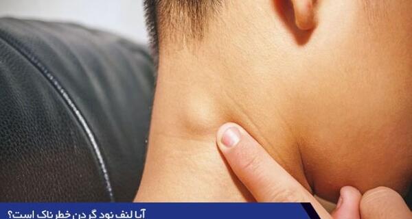 عکس های نود چیست