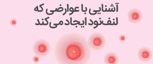 عکس های نود چیست