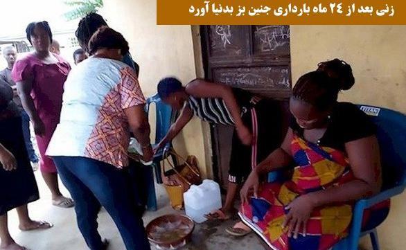 عکس بافت جنین