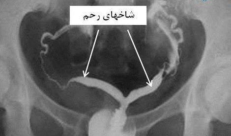 عکس حنا روی دست بلوچی