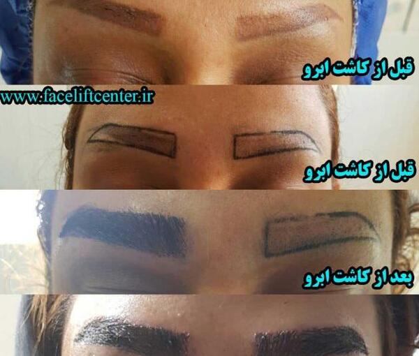 عکس ابرو شمر