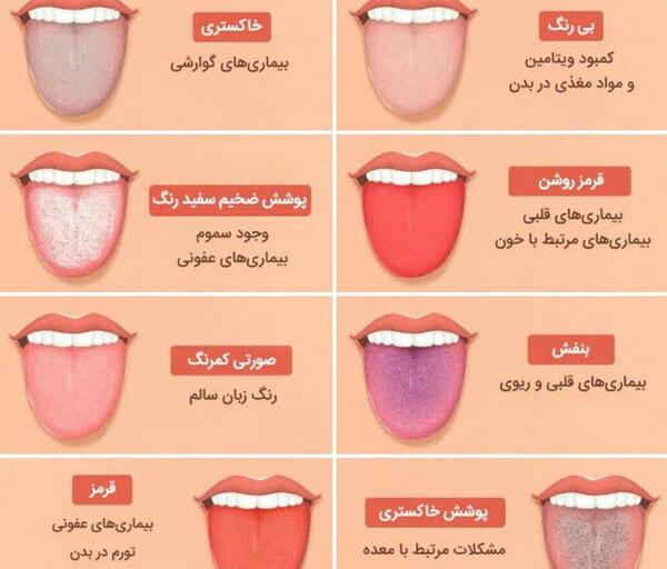 عکس زبان روزه
