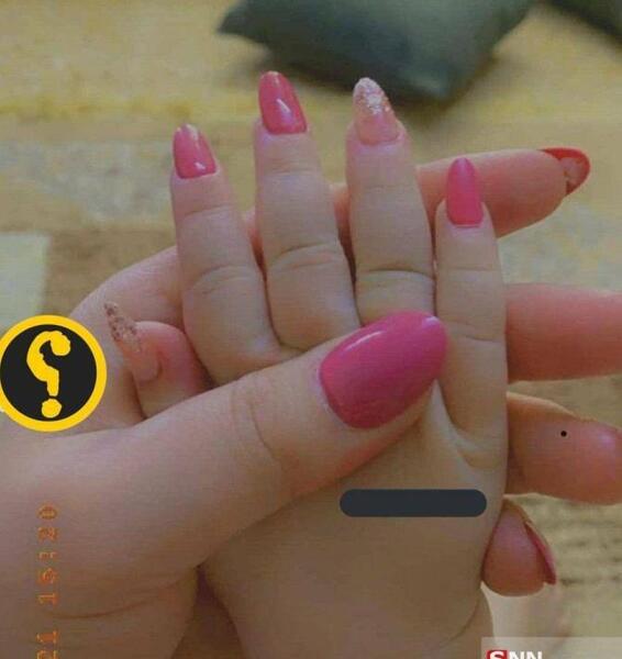 عکس کاشت ناخن واقعی