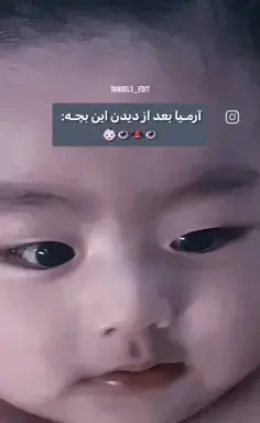 عکس پارک مین یانگ قبل از عمل