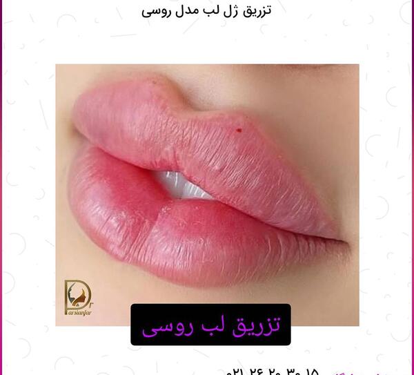 عکس ژل عروسکی