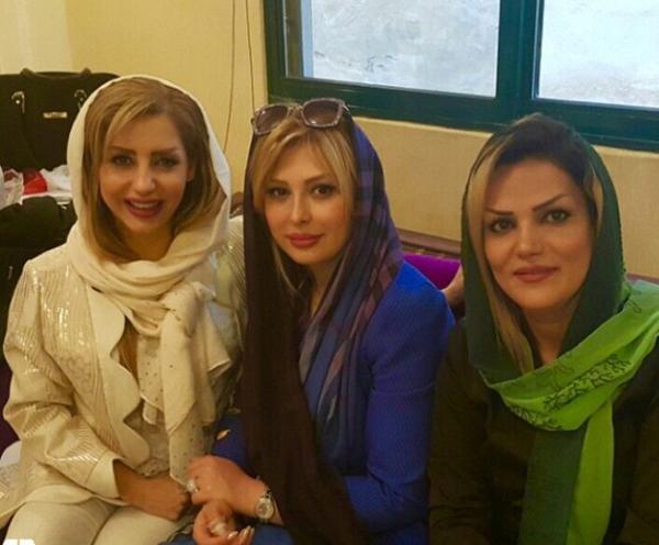 عکس نیوشا ضیغمی قبل عمل زیبایی