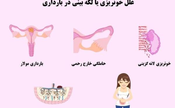 عکس تصاویر لکه بینی در بارداری