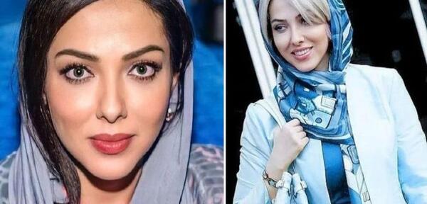 عکس لیلا اوتادی قبل از عمل بینی