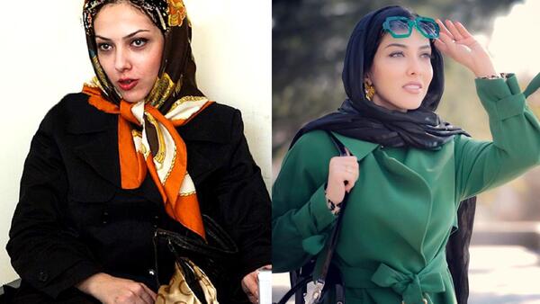عکس لیلا اوتادی قبل از عمل بینی