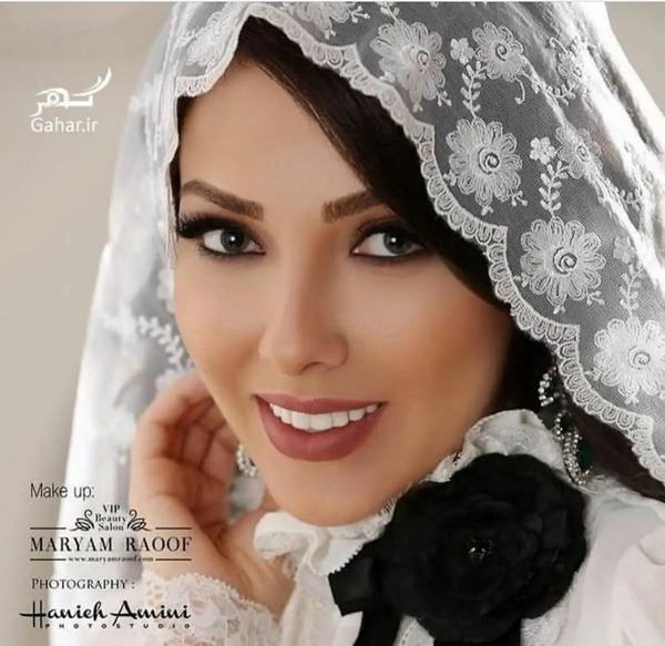 عکس لیلا اوتادی قبل از عمل بینی