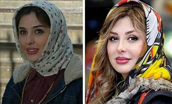 عکس قبل از عمل نیوشا ضیغمی