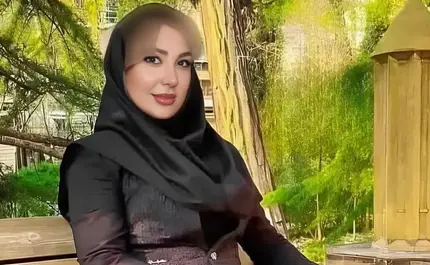 عکس قبل از عمل نیوشا ضیغمی