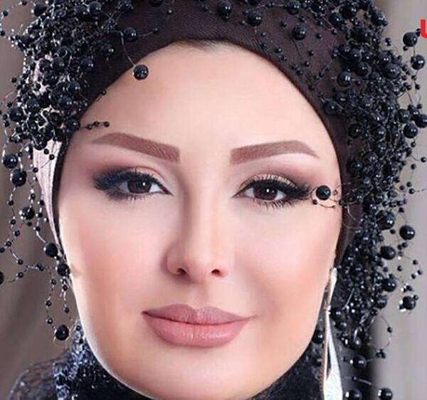 عکس قبل از عمل نیوشا ضیغمی