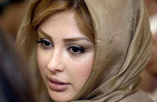 عکس قبل از عمل نیوشا ضیغمی