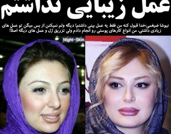 عکس قبل از عمل نیوشا ضیغمی