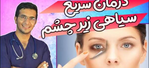 عکس کبودی چشم دختر