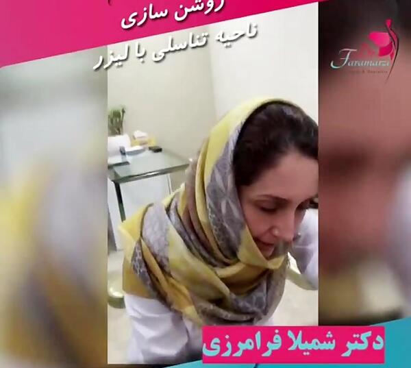 عکس دستگاه لیزر ژولیت
