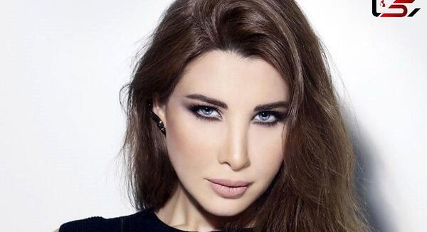 عکس قبل جراحی نانسی